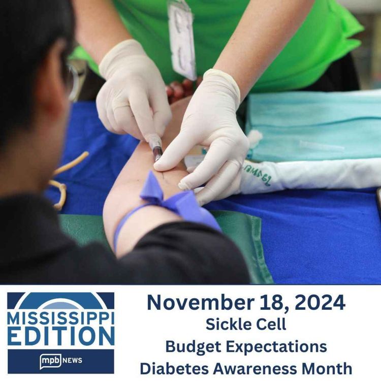 cover art for 11/18/2024: Sickle Cell | Budget Expectations | Diabetes Awareness Month