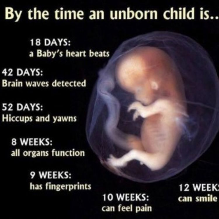 cover art for NutriMedical Report Show Friday April 12th 2019 – Hour Three – Pastor Butch Paugh, Truth About US Christian Inaction on Unborn, Truth re Trump and Apollo, Son in Law Kusher Cabalistic Warlock, Treaty with Israel Handed to Golden Boy Kusher by Trump,