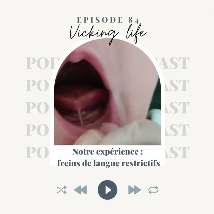 cover art for Notre experience - frein de langue restrictif