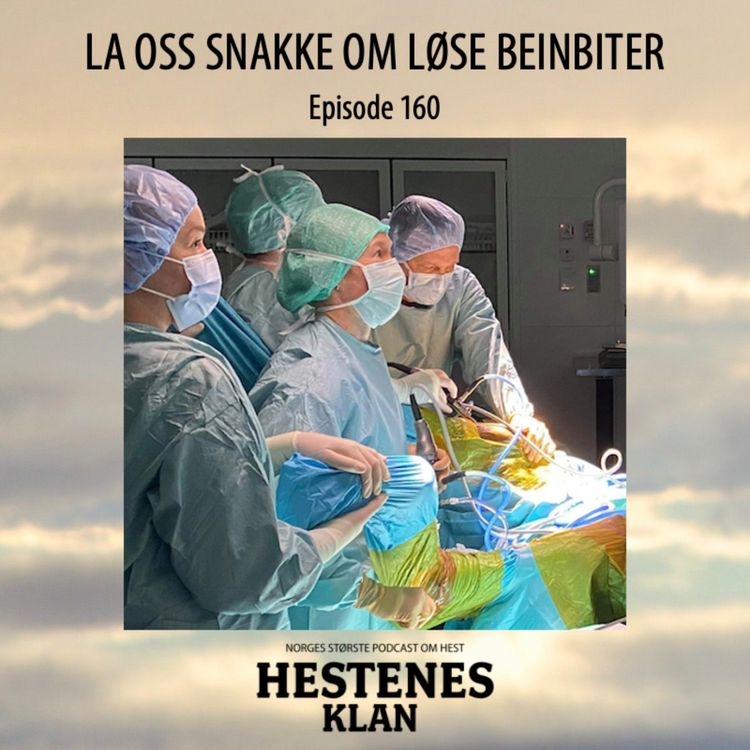 cover art for TRAILER: Episode 160