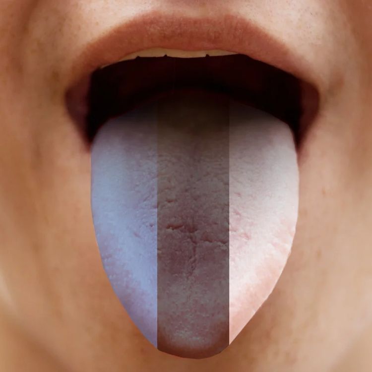 cover art for Spesial: Hvordan kan Estland knuse Norge på PISA – med mindre ressurser?