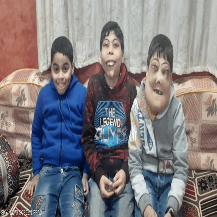 cover art for تحرك سريع من جانب الحكومة المصرية لعلاج أطفال مصابين بمرض نادر