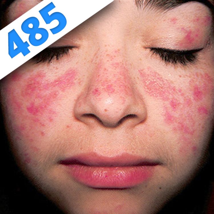 cover art for 485 - Le Lupus