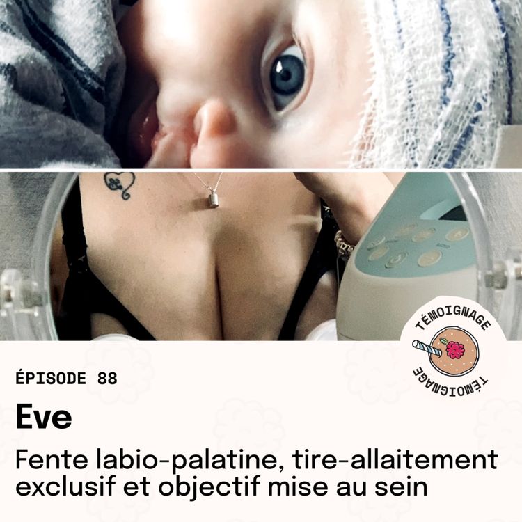 cover art for Épisode 88 - Eve : Fente labio-palatine, tire-allaitement exclusif et objectif mise au sein