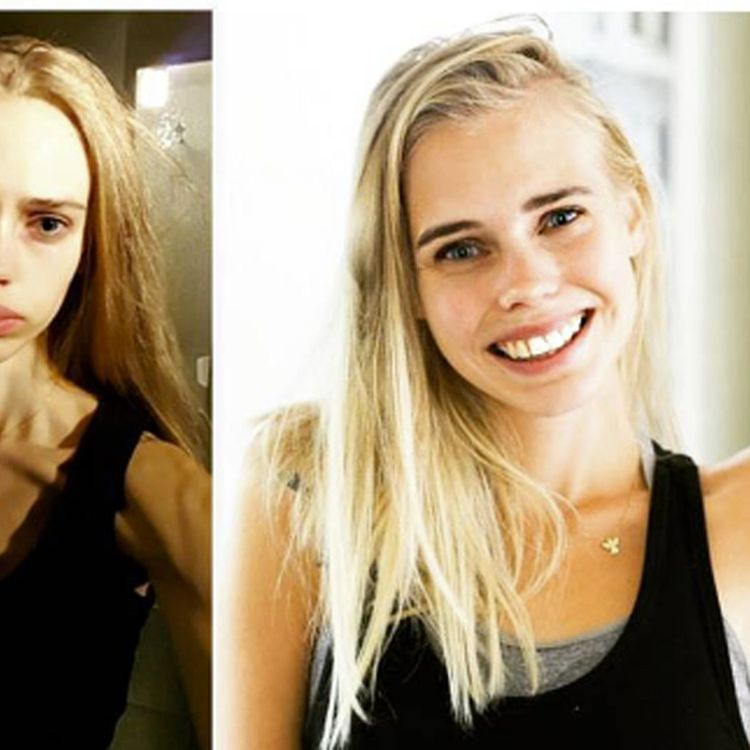 cover art for 103. INTERVJU: Pernilla "Pillan" Thelaus om Anorexi