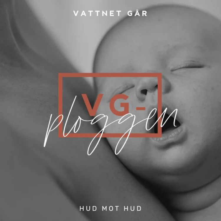 cover art for 531. VG-Ploggen, Hud mot hud - tänk på det här! (Repris)
