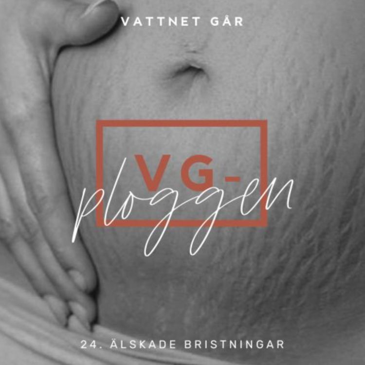 cover art for 633. VG-ploggen - Vad är havandeskapsförgiftning?