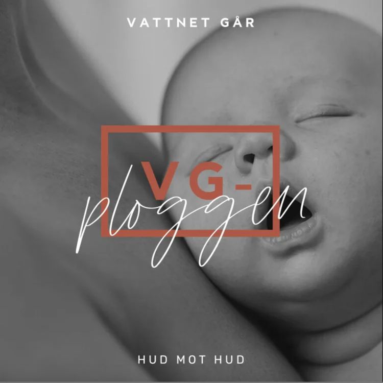 cover art for 748. VG-ploggen - 'Hud mot hud - varför då?'