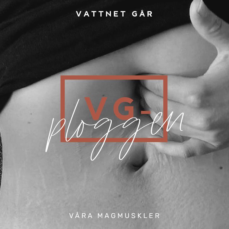 cover art for 315. VG-ploggen: Hjälp, mina magmuskler har delats!