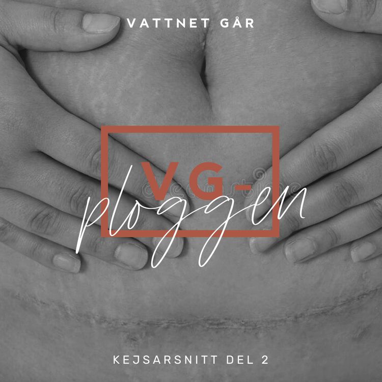 cover art for 263. VG-ploggen - Kejsarsnitt del 2, Det händer efter snittet