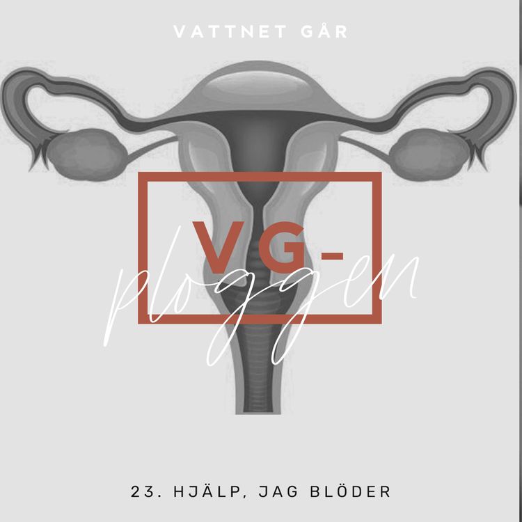 cover art for 125. VG-ploggen, Vårt mäktiga blödande