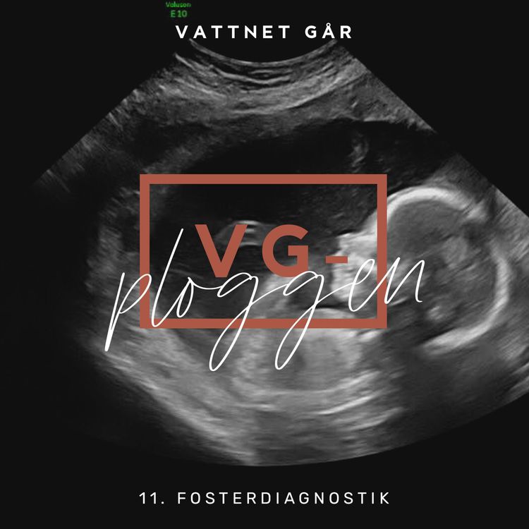 cover art for 103. VG-ploggen, Det spännande ultraljudet!