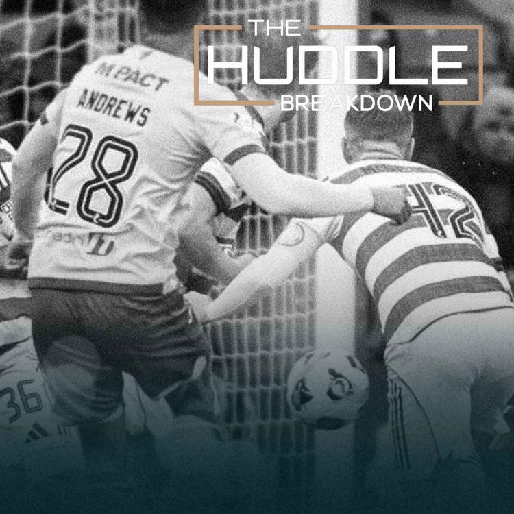 cover art for Celtic's Tactical Crisis: Hibs Defeat, Pressing Data Exposed, Final Third Effectiveness + Derby Fear