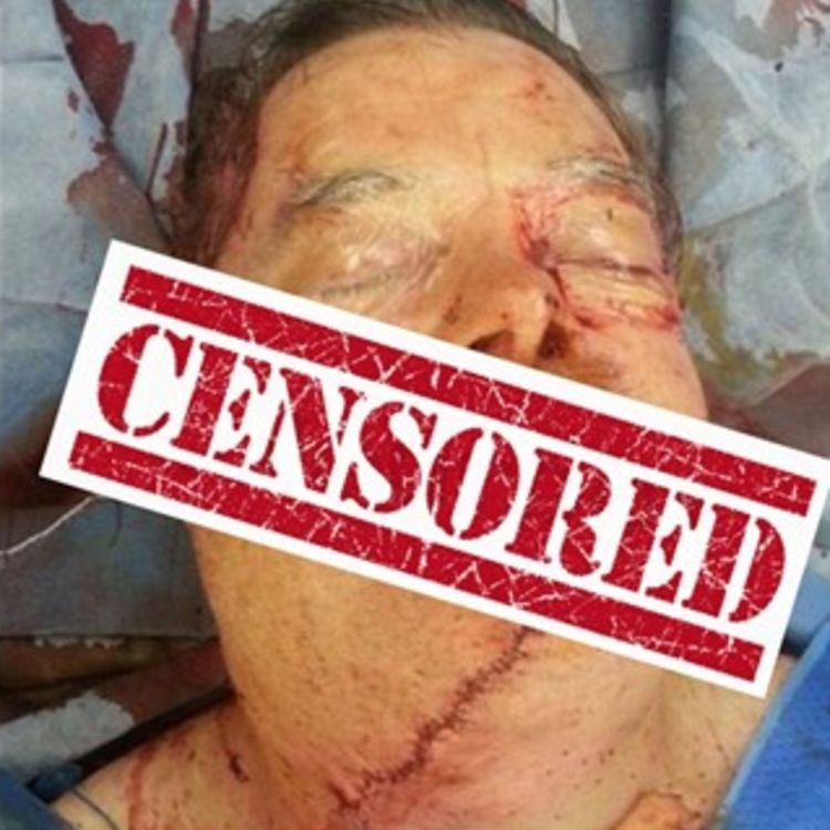 cover art for I sliced off my face with a chainsaw!