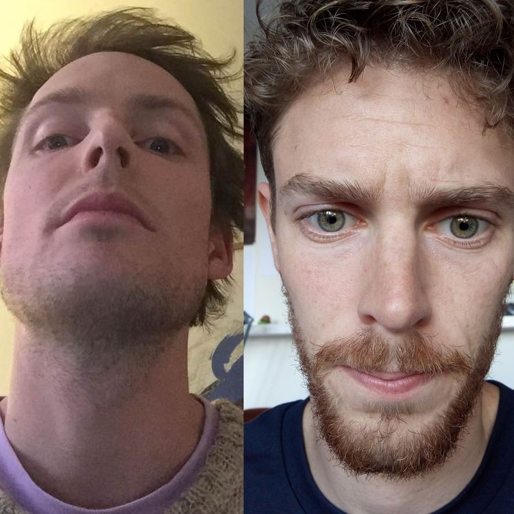 cover art for Episode Five - DadHead