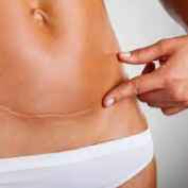 cover art for Cesárea por solicitud materna