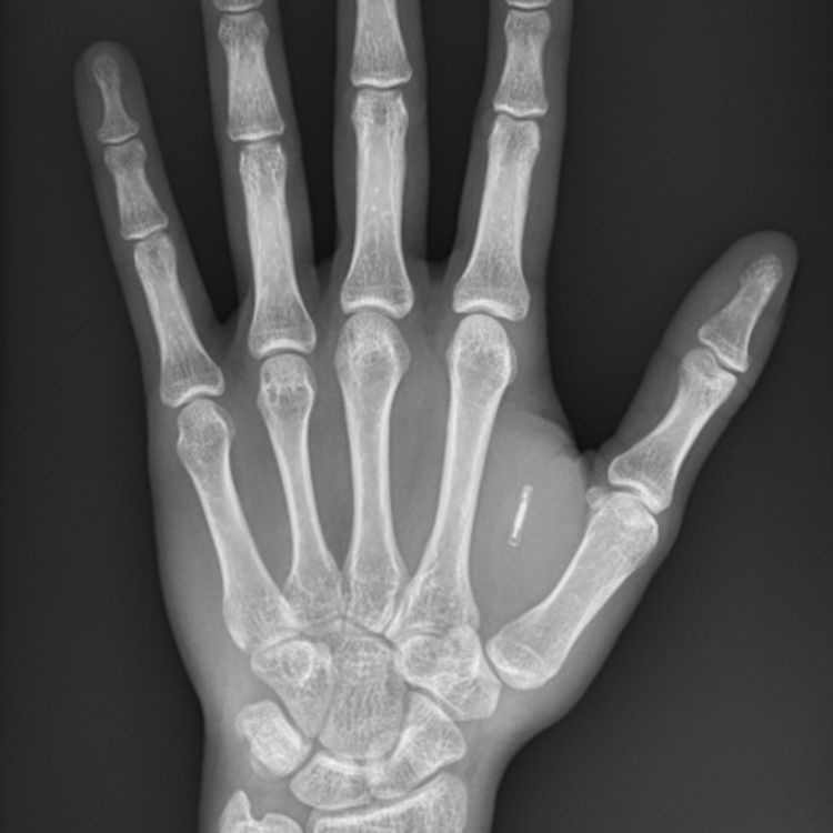 cover art for Gentoo, доработки человека и многое другое