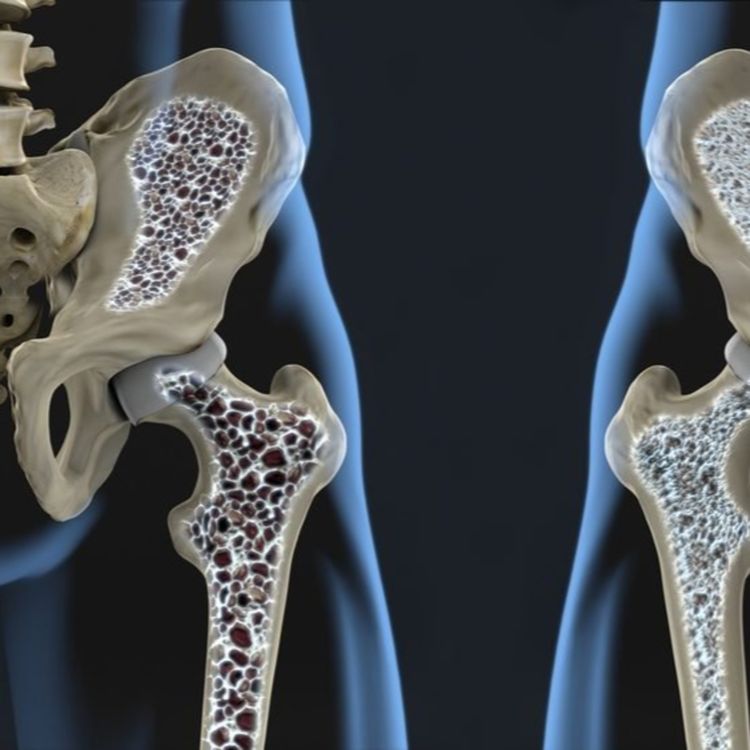 cover art for #76 - Kemik mineral yoğunluğu kas gücünü etkileyebilir mi?