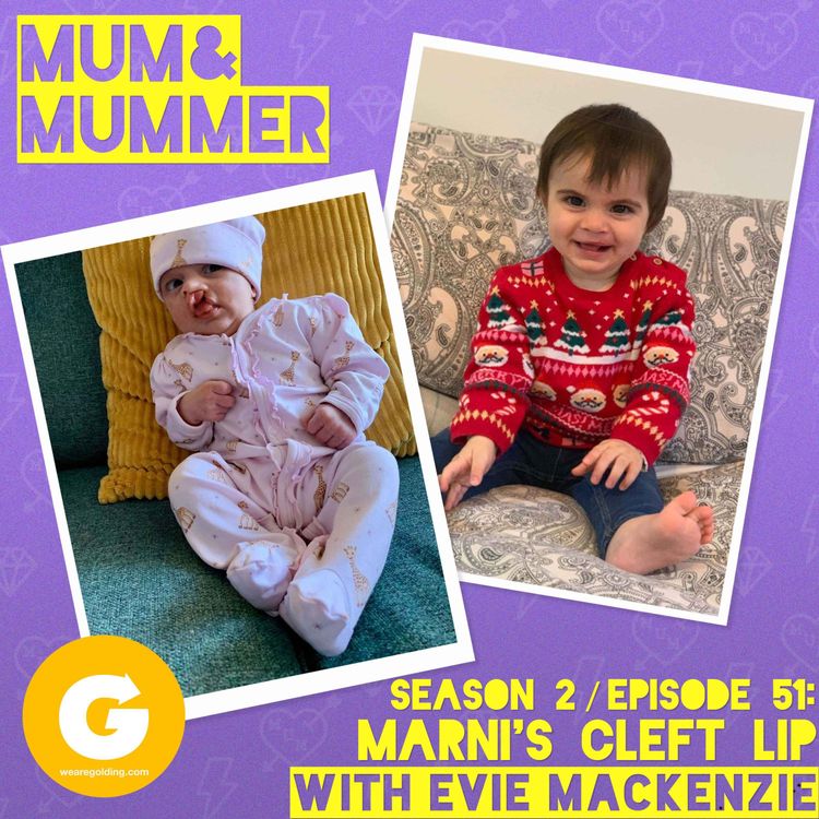 cover art for Marni's Cleft Lip with Evie Mackenzie