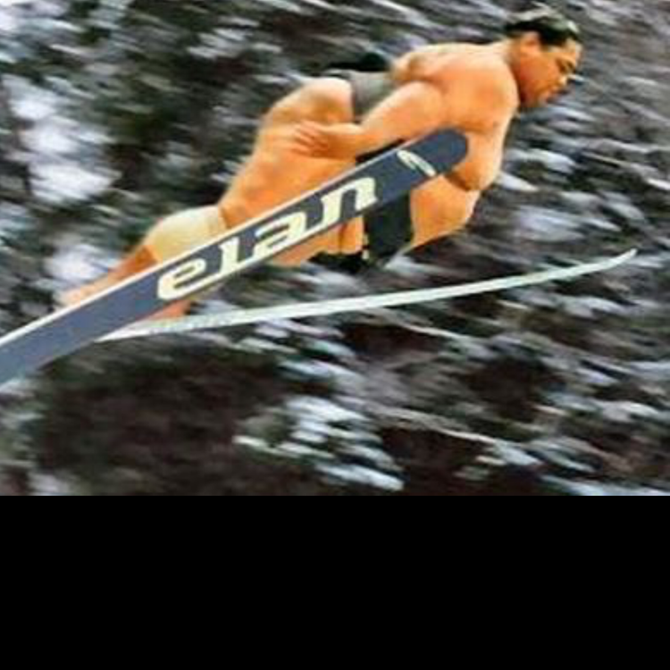 cover art for Episode 31: Flakey scalp and spitting chicken