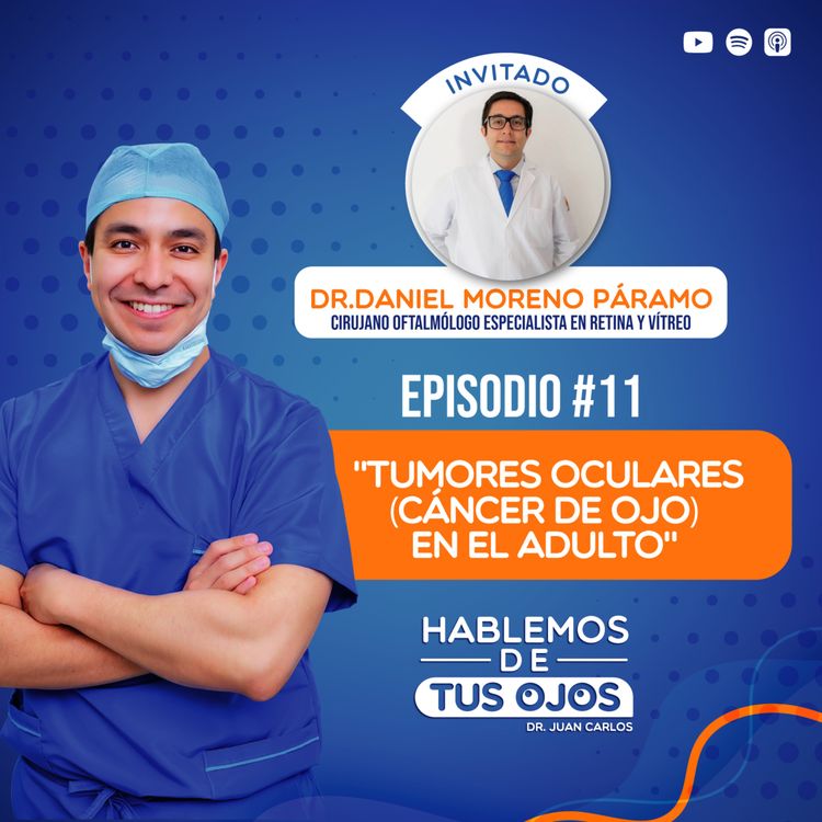cover art for Hablemos sobre TUMORES OCULARES