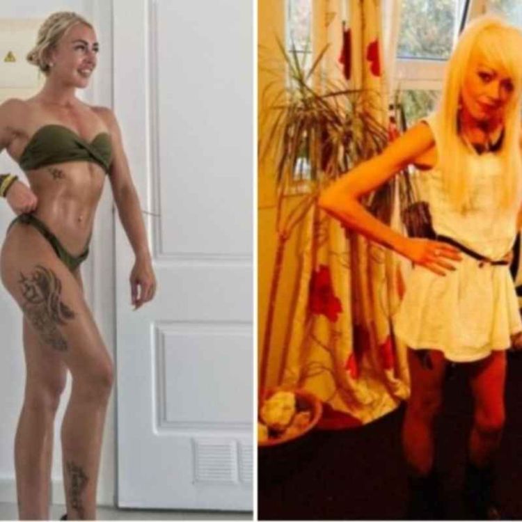 cover art for Surviving Anorexia