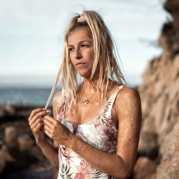 cover art for «Les réseaux ont changé ma vie» (2/5) : Julie Bourges, grande brûlée, en guerre contre les complexes