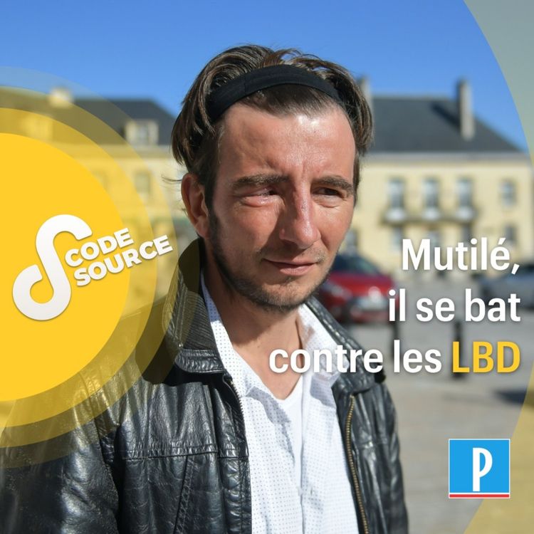 cover art for Mutilé, il se bat contre les LBD