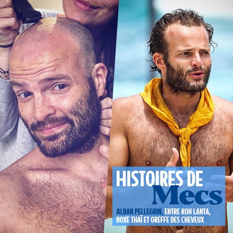 cover art for Alban Pellegrin, de Koh Lanta à sa greffe des cheveux