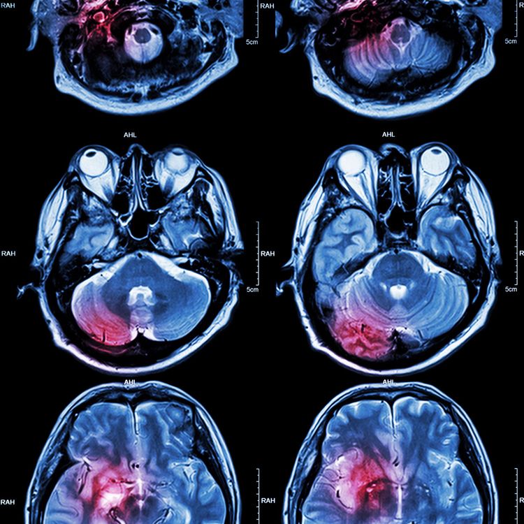 cover art for Shining a light on the brain