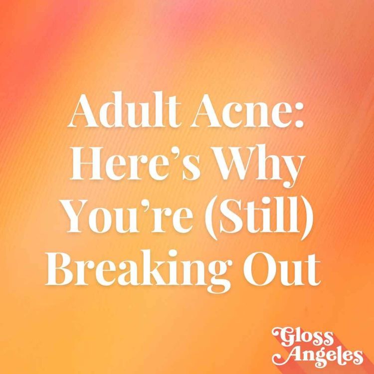 cover art for Adult Acne: Here’s Why You’re (Still) Breaking Out
