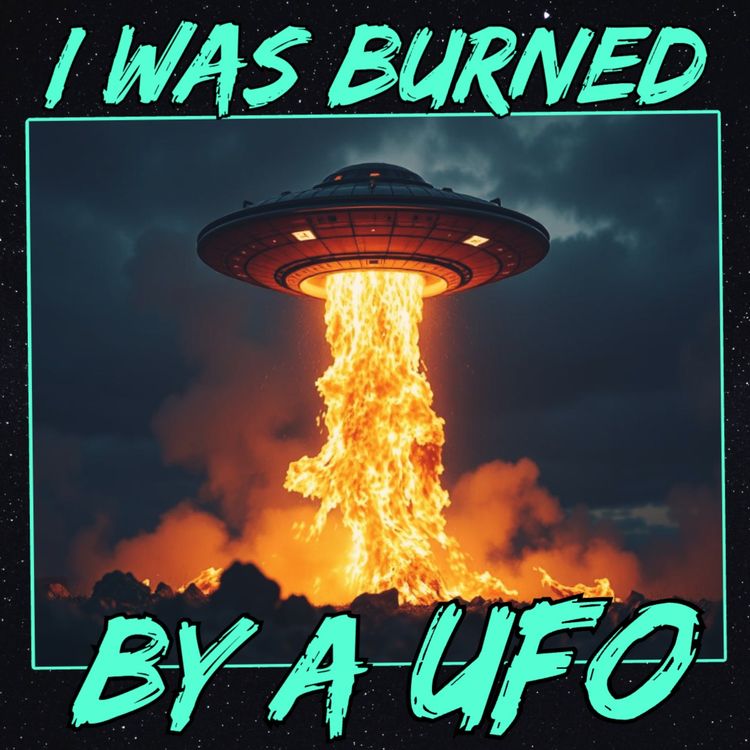 cover art for I Was Burned by a UFO
