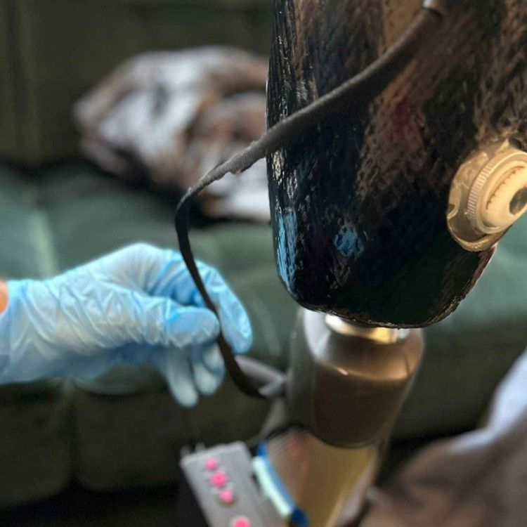 cover art for New material makes prosthetics comfier for amputees
