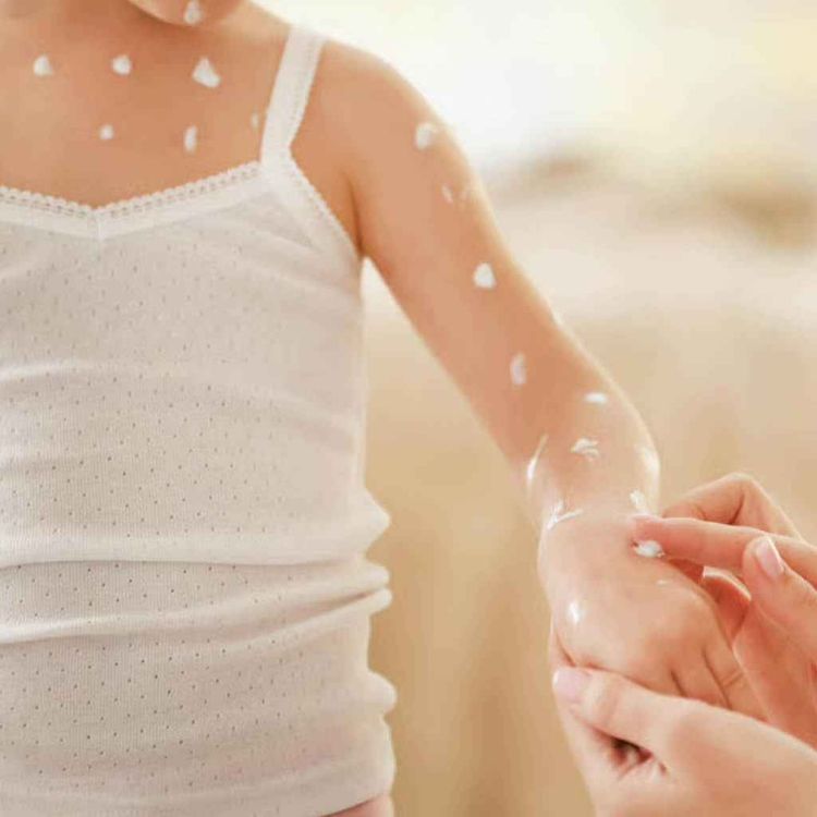 cover art for NHS chickenpox vaccine, Microsoft's AI models, and glow in the dark plants, plus more