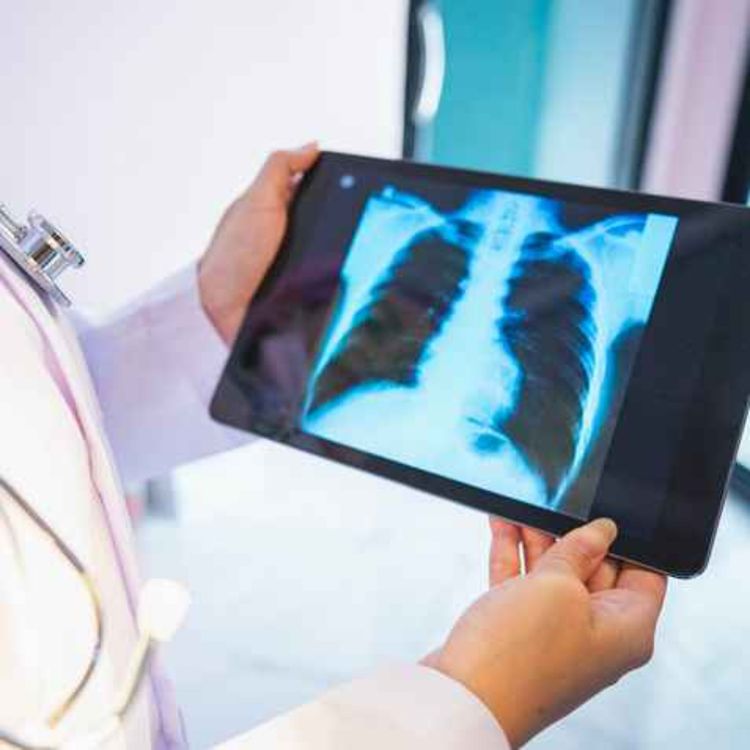 cover art for Limerick women shares her journey with lung fibrosis
