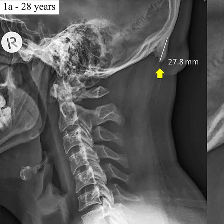 Are Teens Growing Horns Because of Their Smartphones?! Em, Nope. - Room ...