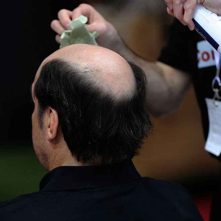 cover art for 5513: LISTEN¦ Is there still a taboo around toupées? Sales of hairpieces have gone up 43% in the last year, with between a third and half of men under 50 experiencing hair loss. Would you wear one? Frank spoke to Alanna Sharratt from Man Grooming