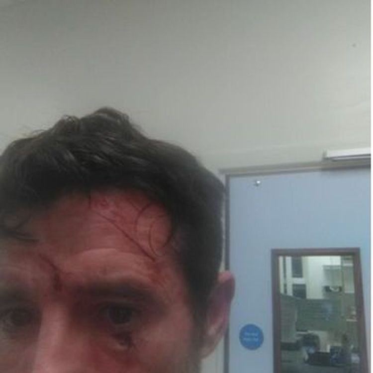 cover art for PODCAST EXTRA STABBED TO SAVE A WOMAN - I'D DO IT AGAIN Tony's Story