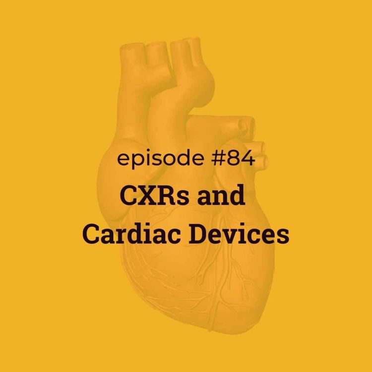 cover art for #84 CXRs & Cardiac Devices