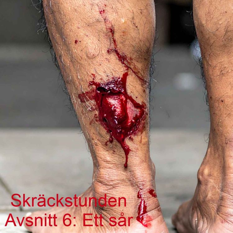 cover art for 6. Ett sår