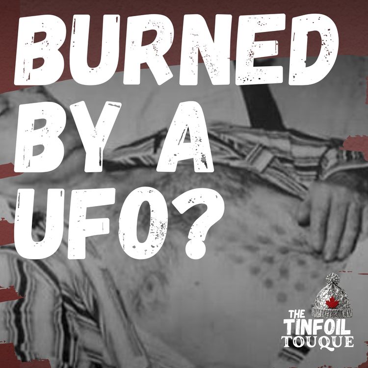 cover art for Burned by a UFO? The Falcon Lake Incident
