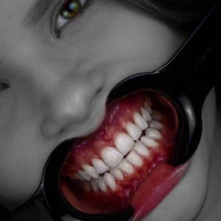 cover art for 139- Prosthetic Materials in Implant Crown :part1