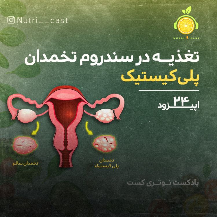 cover art for اپیزود بیست و چهار : تغذیه در سندروم تخمدان پلی کیستیک 