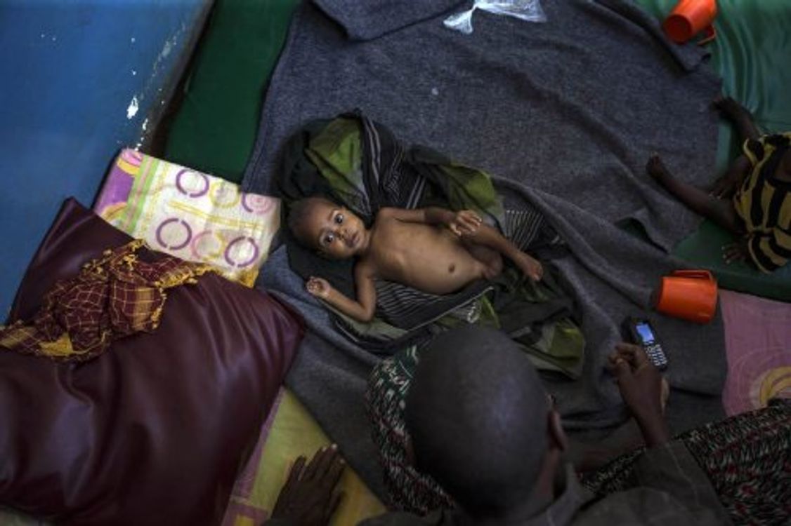 cover art for Cientos de niños mueren en Somalia y son enterrados "como basura", según la ONU.