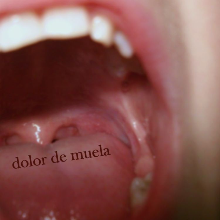 cover art for dolor de muela