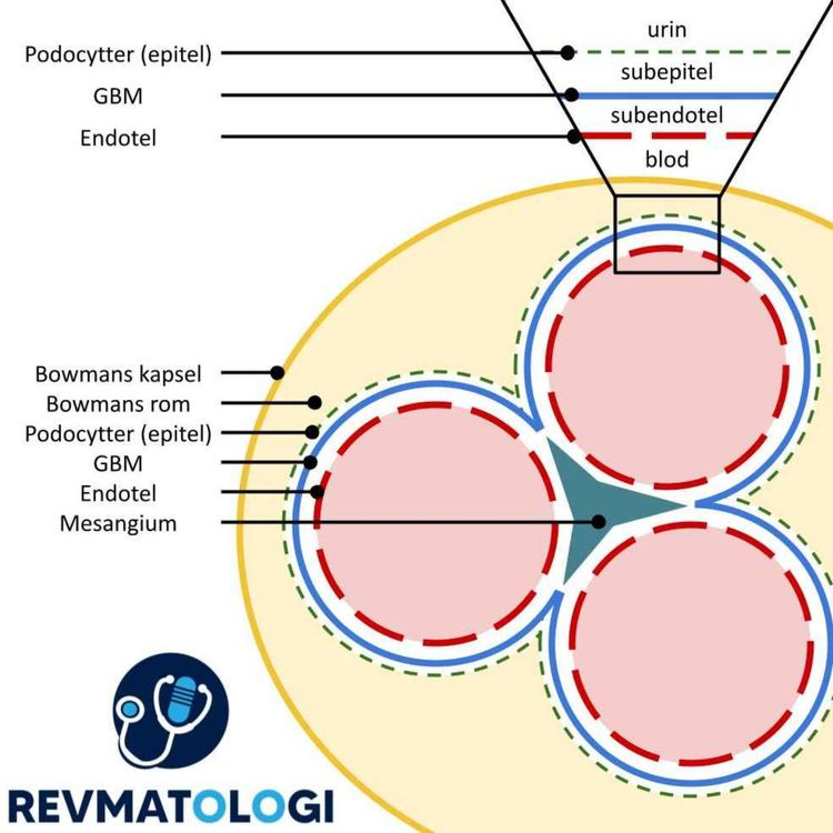 cover art for Glomerulonefritt del 1: patofysiologi, presentasjoner og utredning