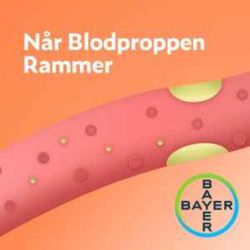 cover art for Når blodproppen rammer