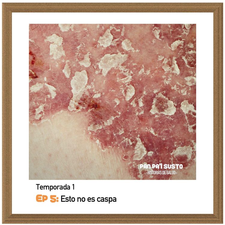 cover art for Esto no es caspa | Itzel Gómez