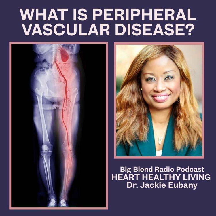 cover art for What Is Peripheral Vascular Disease?