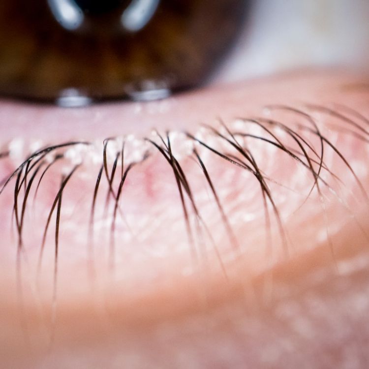 cover art for Eyelash (miishaabiwinaan) - Anishinaabe WOTD